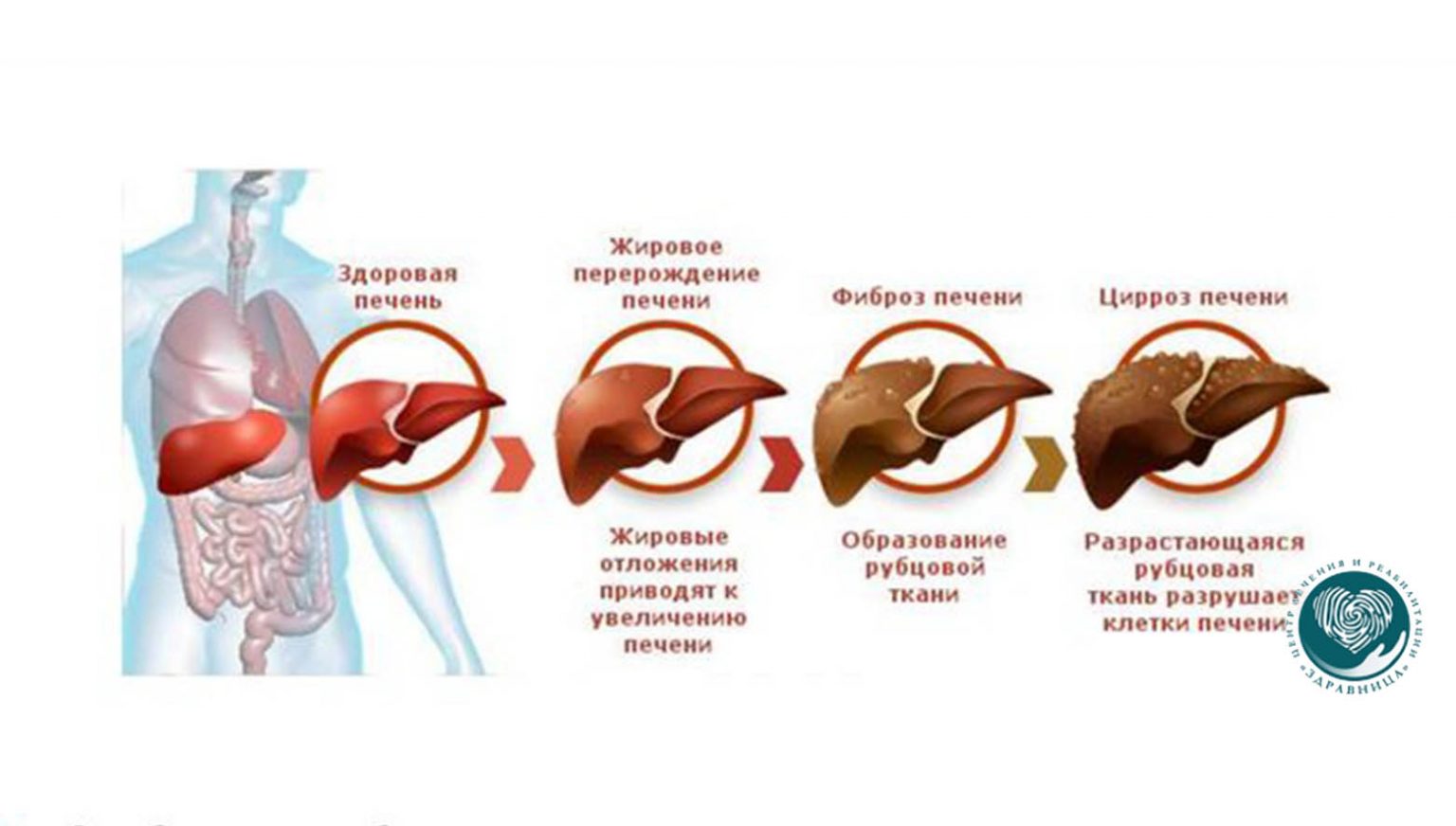 Влияние наркотиков картинки