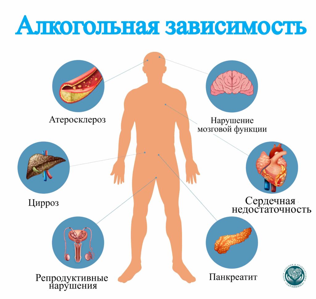 Когда после наркотиков алкоголь требует срочной медицинской помощи