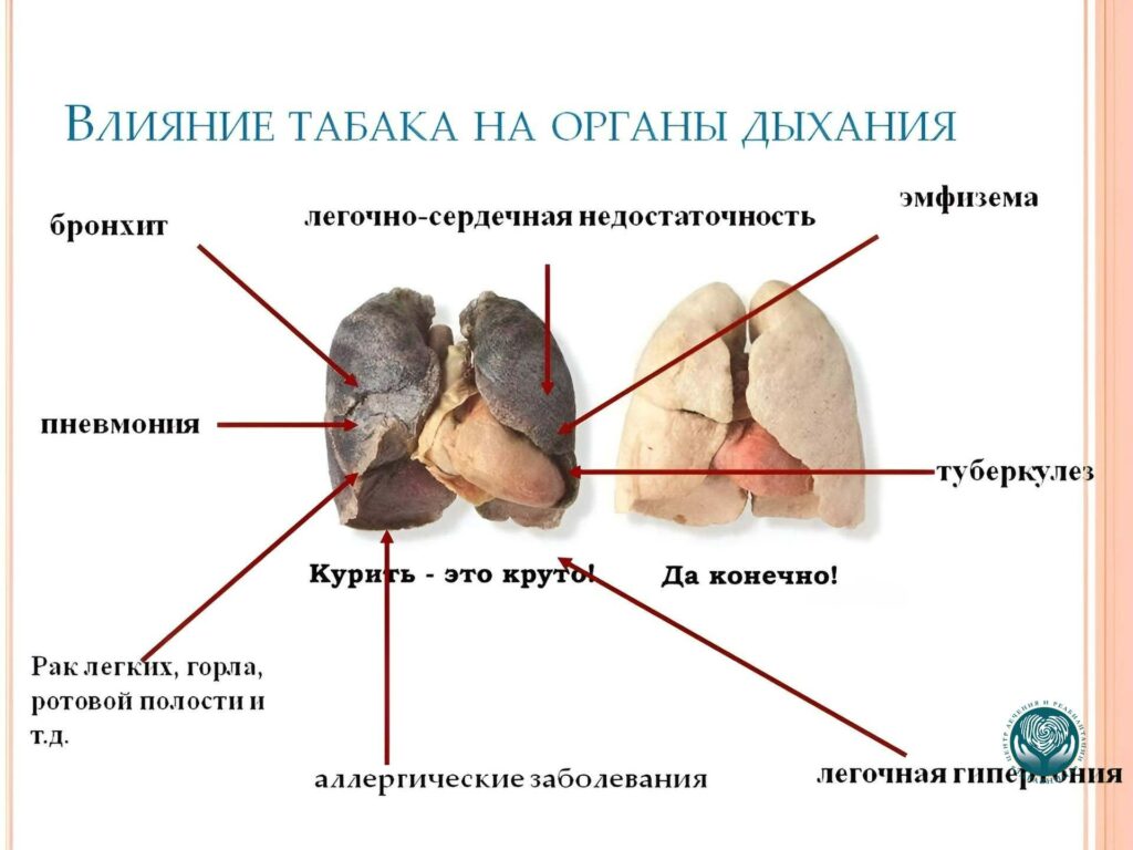 Механизмы канцерогенного действия нагреваемого табака