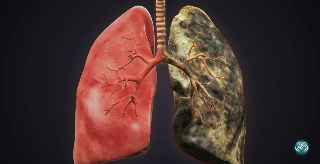 Последствия ежедневного использования Айкоса
