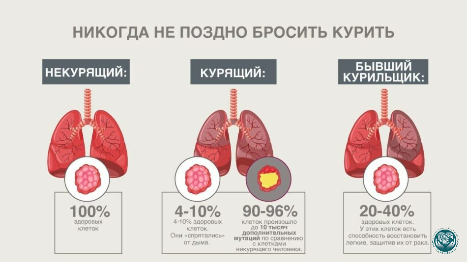 Лёгкие после курения и после отказа от сигарет