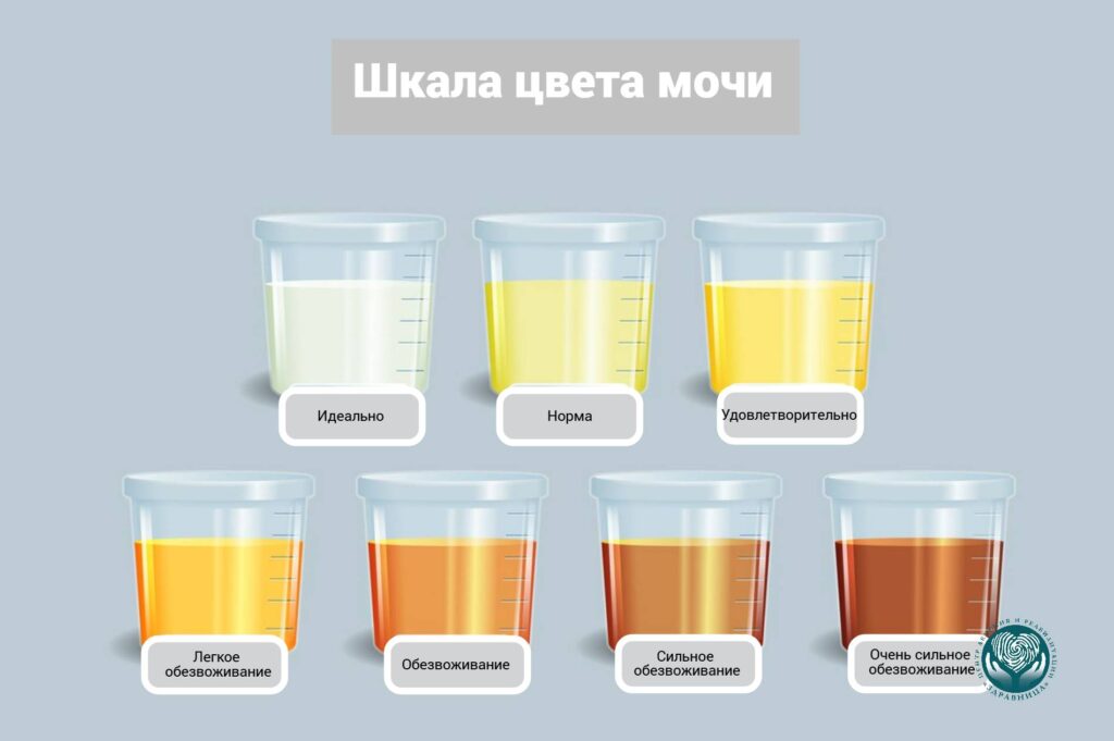 Шкала цвета мочи при обезвоживании