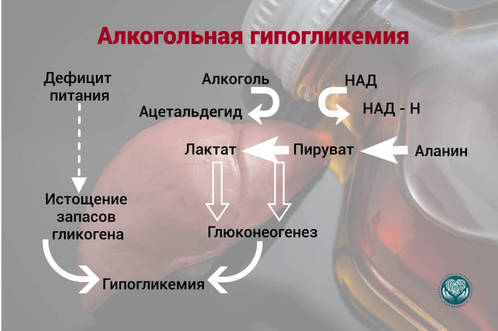 Алкогольная гипогликемия