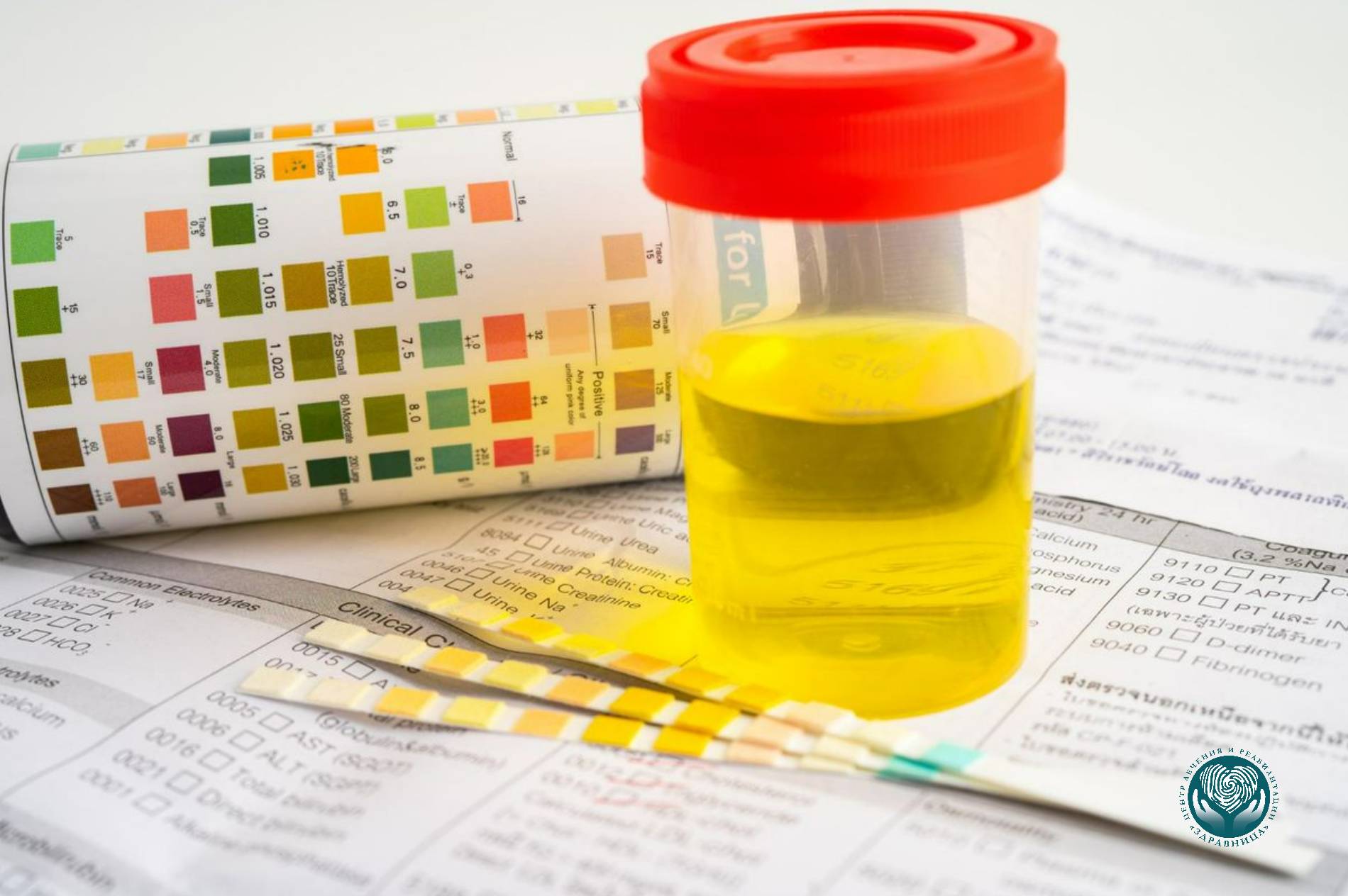 Изменение цвета мочи после запоя