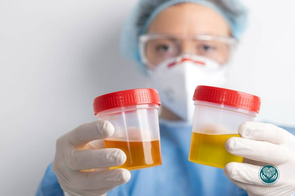 Потемнение мочи: когда это опасный признак