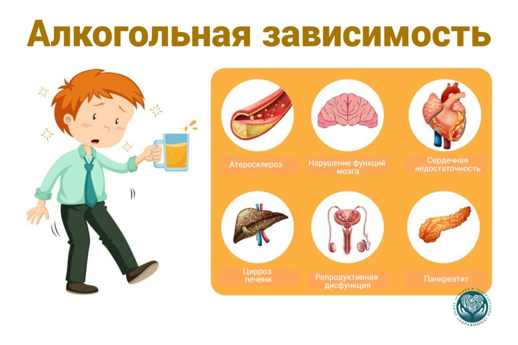 Влияние алкоголя на организм